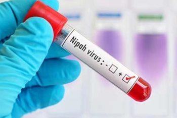 ৩৫ জেলায় নিপাহ ভাইরাস শনাক্ত, হাসপাতালগুলোকে প্রস্তুত থাকার নির্দেশ
