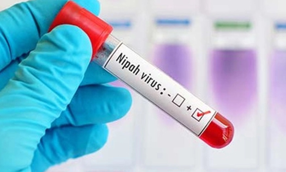 ৩৫ জেলায় নিপাহ ভাইরাস শনাক্ত, হাসপাতালগুলোকে প্রস্তুত থাকার নির্দেশ