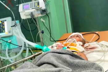 মস্তিষ্কে গুলি রয়ে গেছে শিশু হুজাইফার